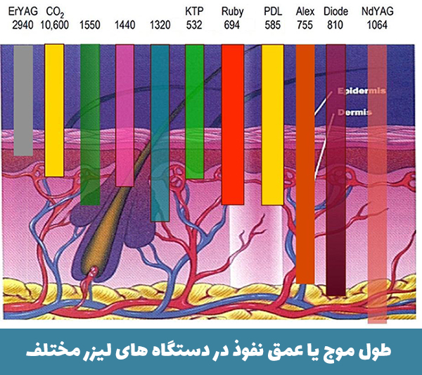 عمق نفوذ لیزر تا پو