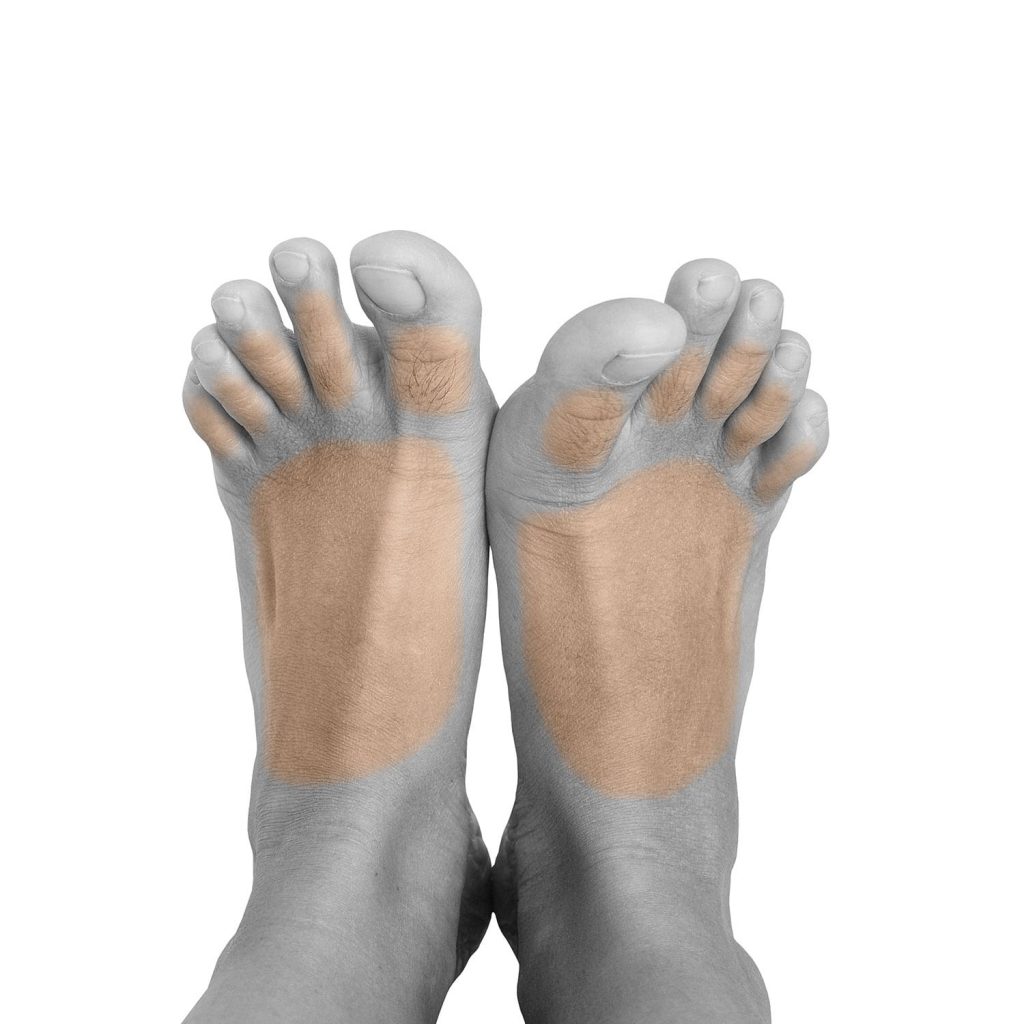 لیزر موهای زائد آقایان