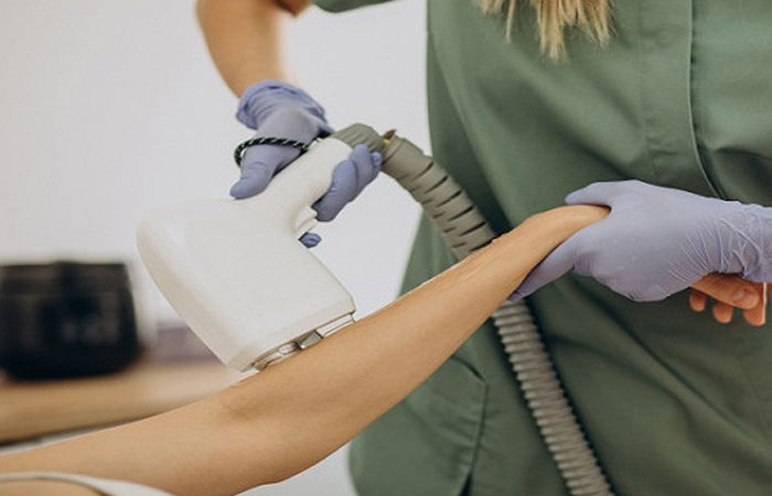 همه چیز درباره لیزر موهای زائد