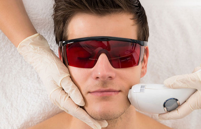 آیا دور چشم را میتوان لیزر کرد؟