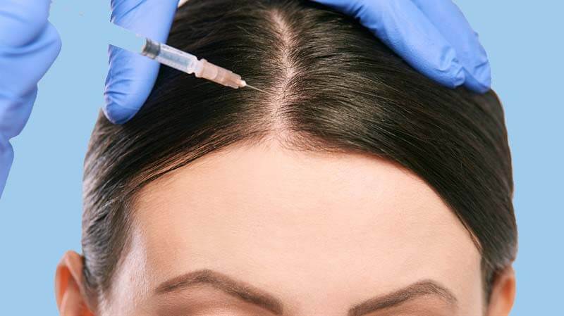 مزوتراپی مو راه حلی برای تقویت موهای اسیب دیده و ضعیف در کلینیک الگانت