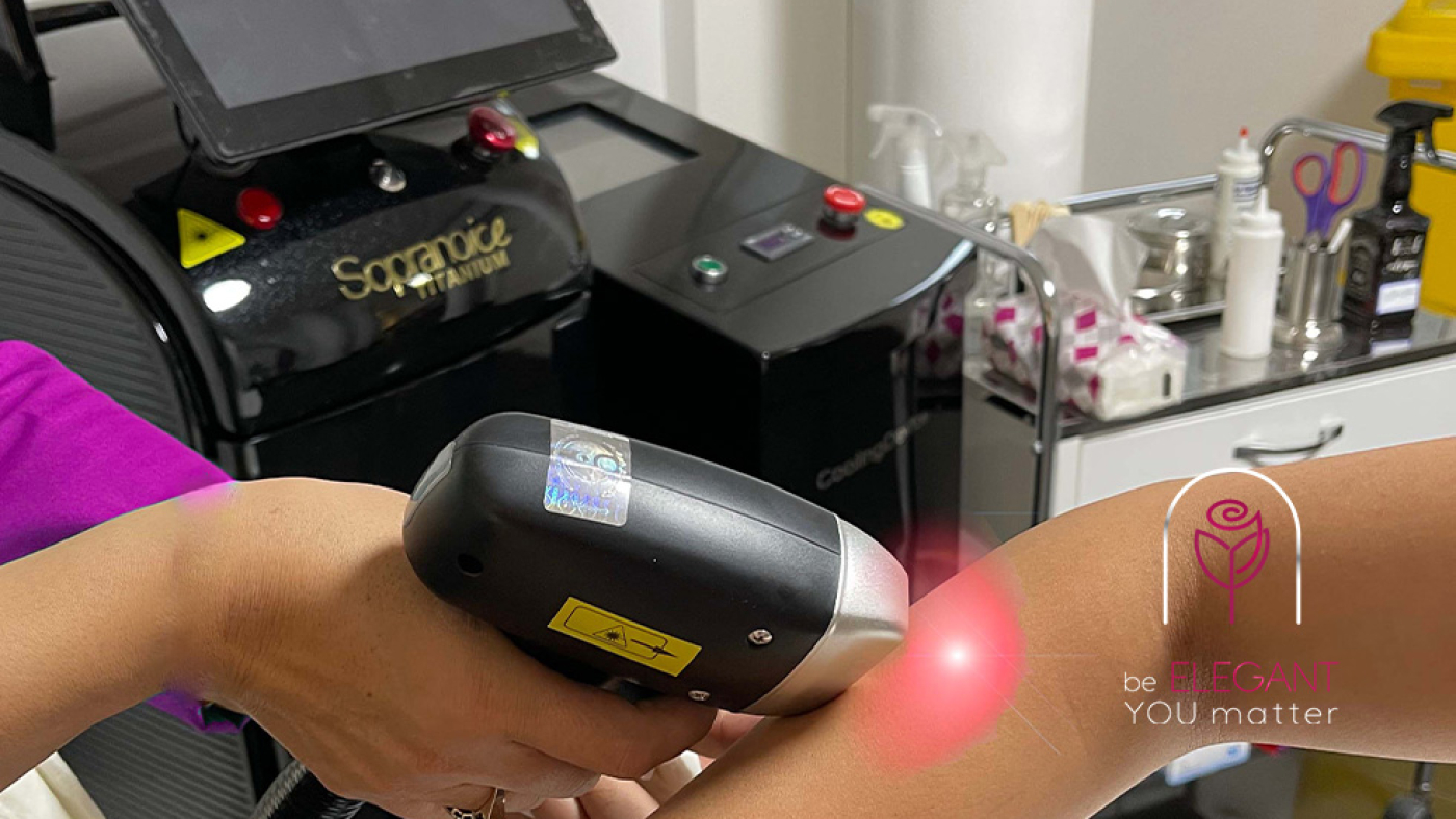 لیزر موهای زائد در ساری