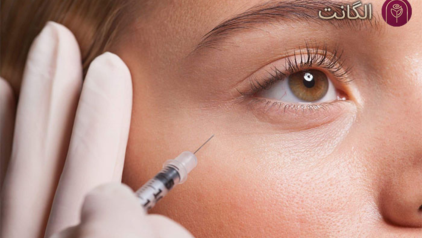 فیلر گودی زیر چشم