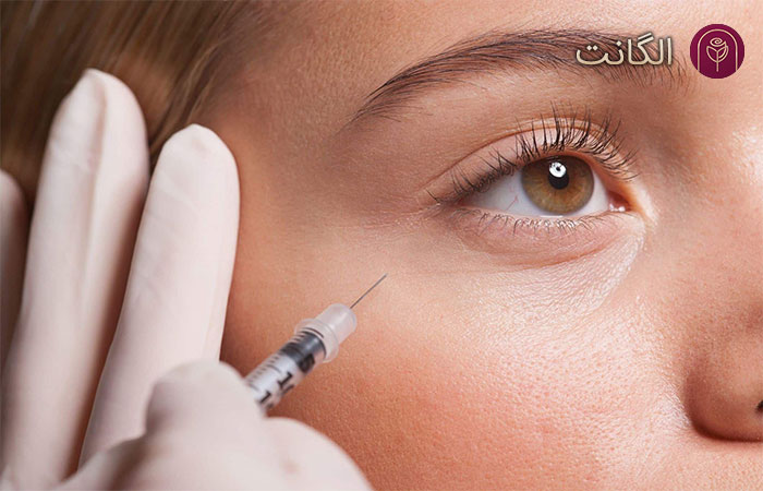 مراقبت‌های پس از تزریق فیلر برای رفع گودی زیر چشم