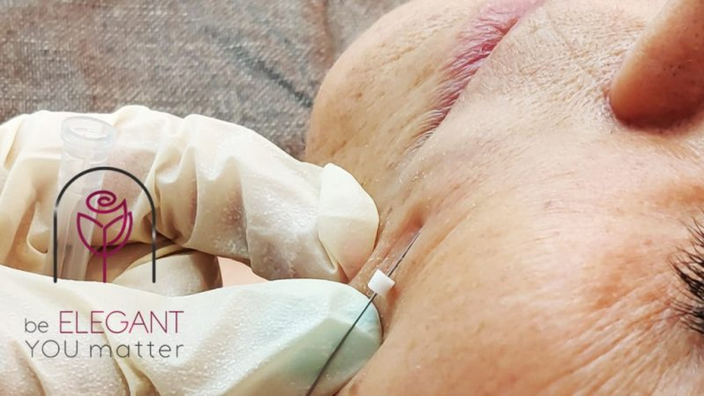 لیفت با نخ کلاژن ساز