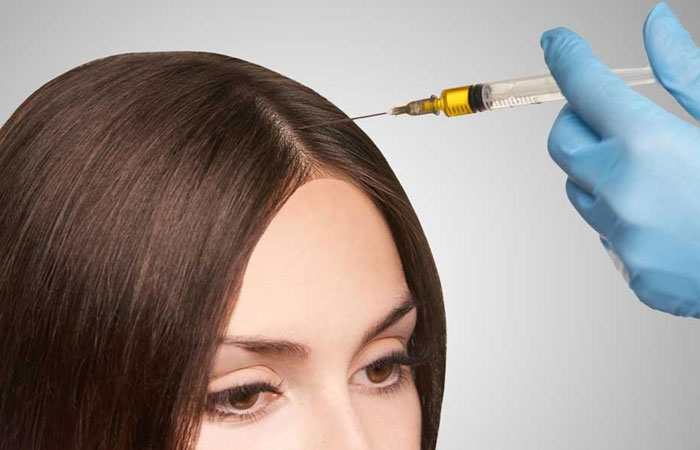 تاثیر هیرفیلر بر رشد موها