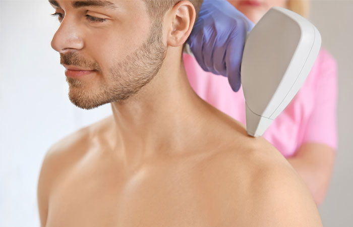 فواید لیزر موهای زائد