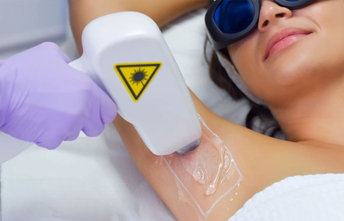 دقت بالای لیزر