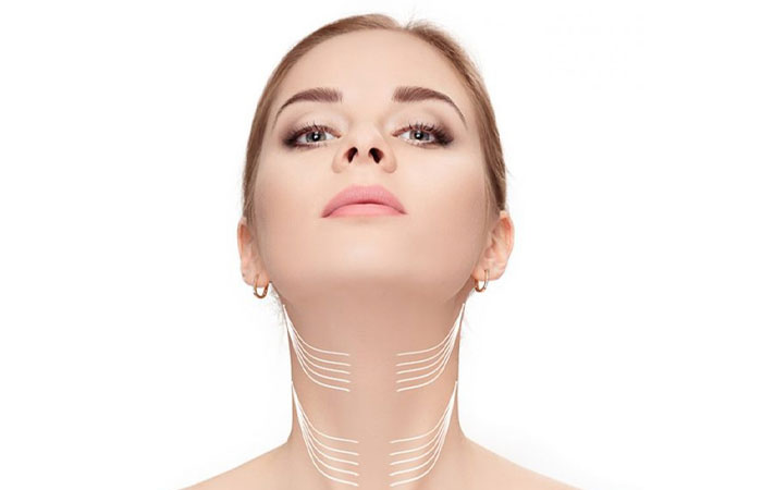 بوتاکس گردن