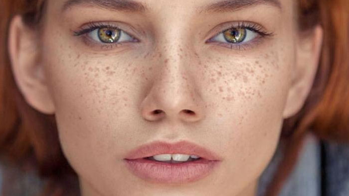 علت ایجاد کک و مک و روشهای پاک کردن آن