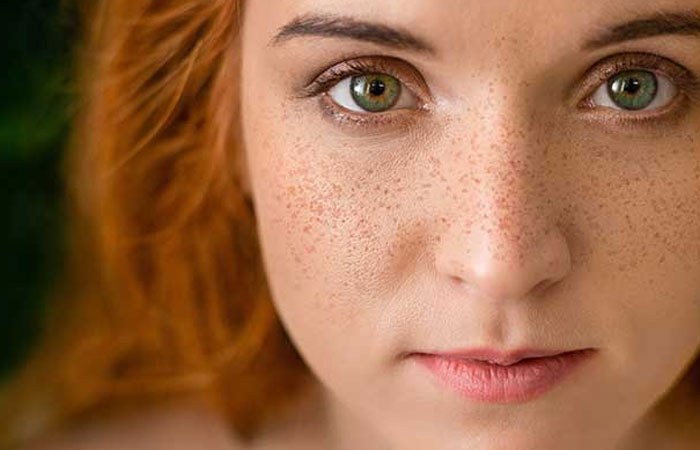 لکههای دوستداشتنی یا ناخوشایند