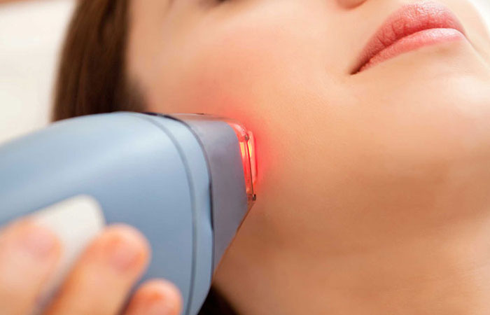 پاکسازی کک و مک با استفاده از لیزر