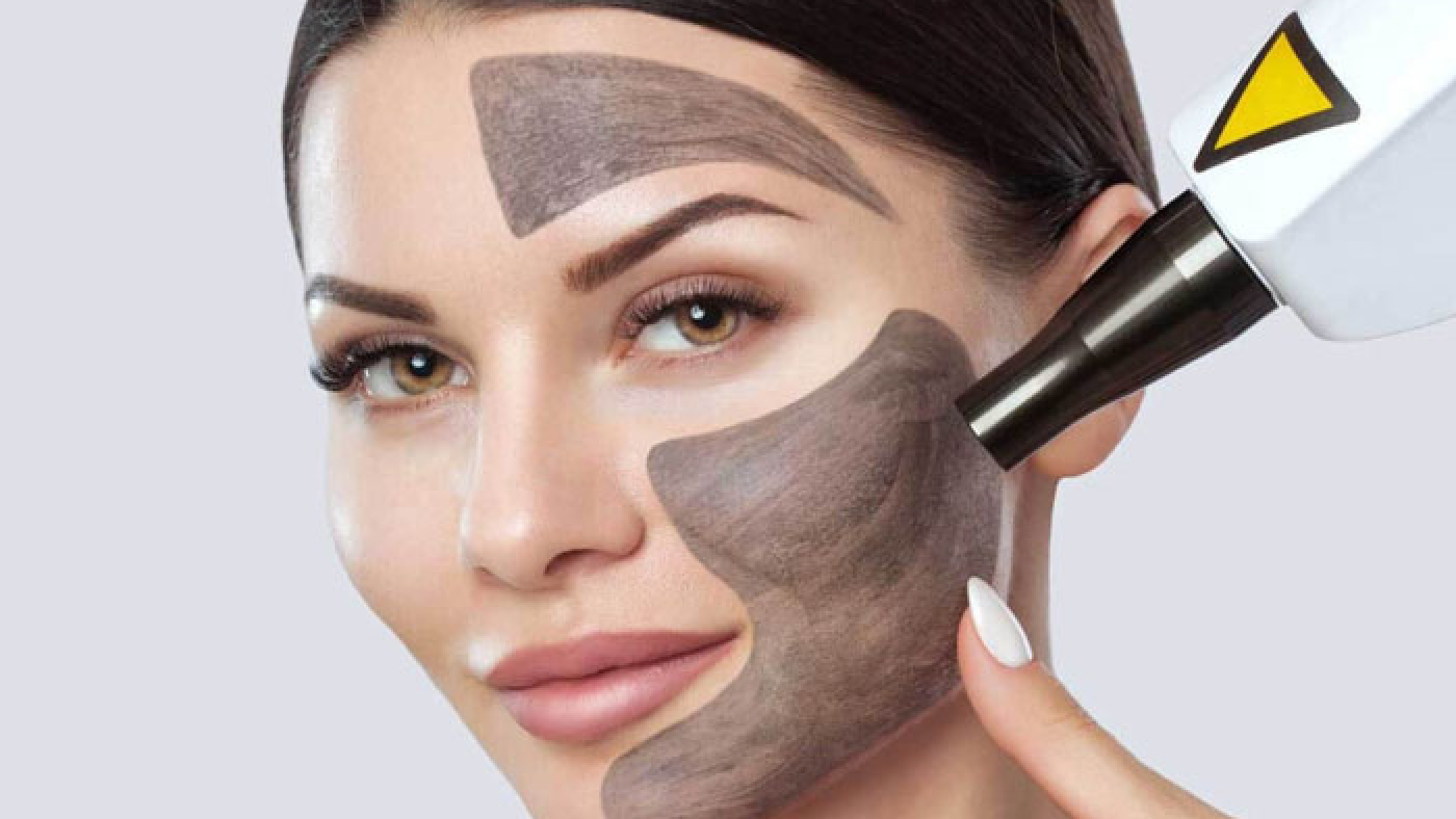 پاکسازی و لایهبرداری پوست به روش لیزر کربن