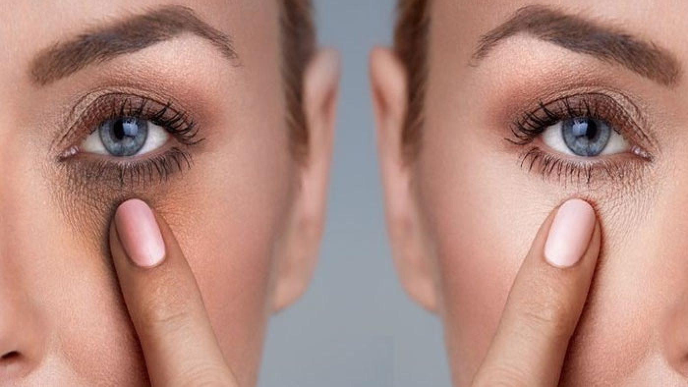 روشن‌تر کردن دور چشم با پاکسازی صورت