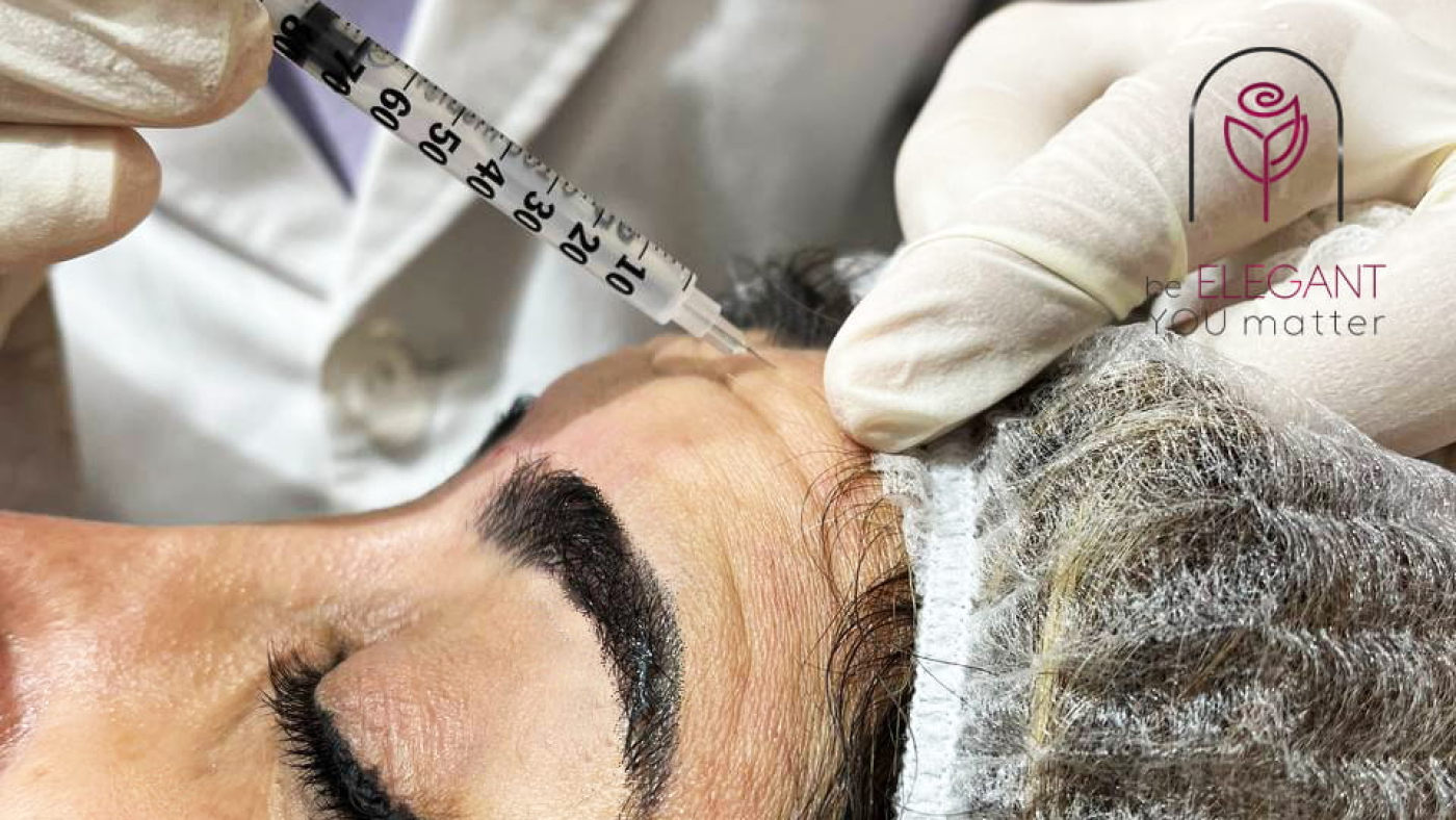 بوتاکس پیشانی