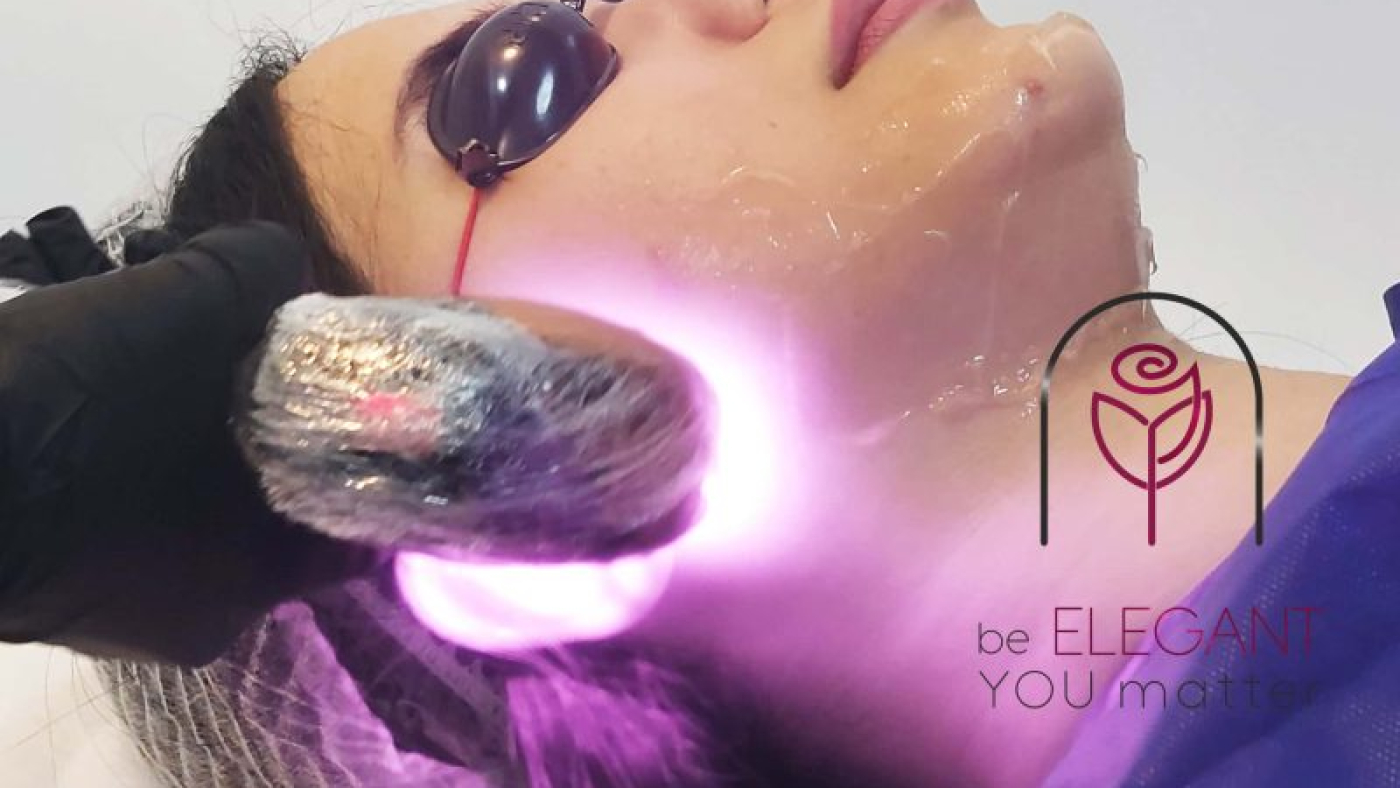 نواحی ممنوع در لیزر موهای زائد