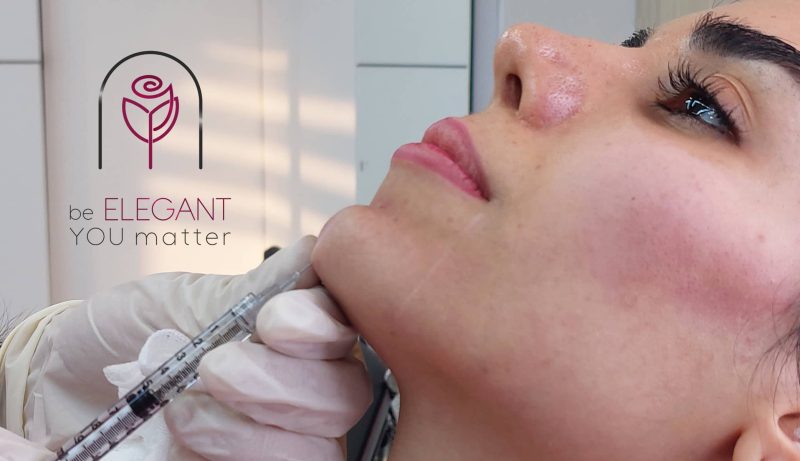 تزریق فیلر چانه سرسوزنبربر روی چانه