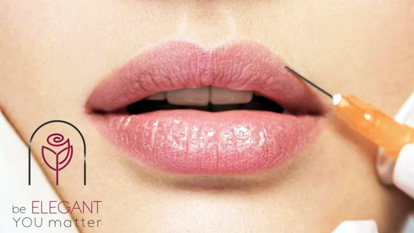 فیلر لب روسی